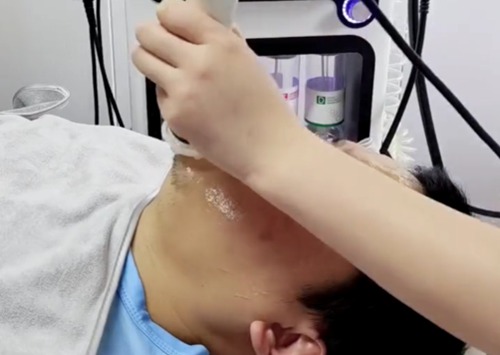 愛(ài)麗絲超氣泡操作流程