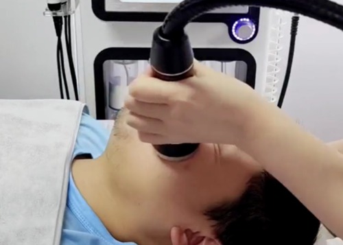 愛(ài)麗絲超氣泡操作流程