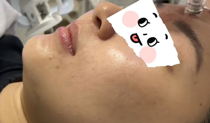 調(diào)Q激光出光不爆破是是什么原因要怎么維修